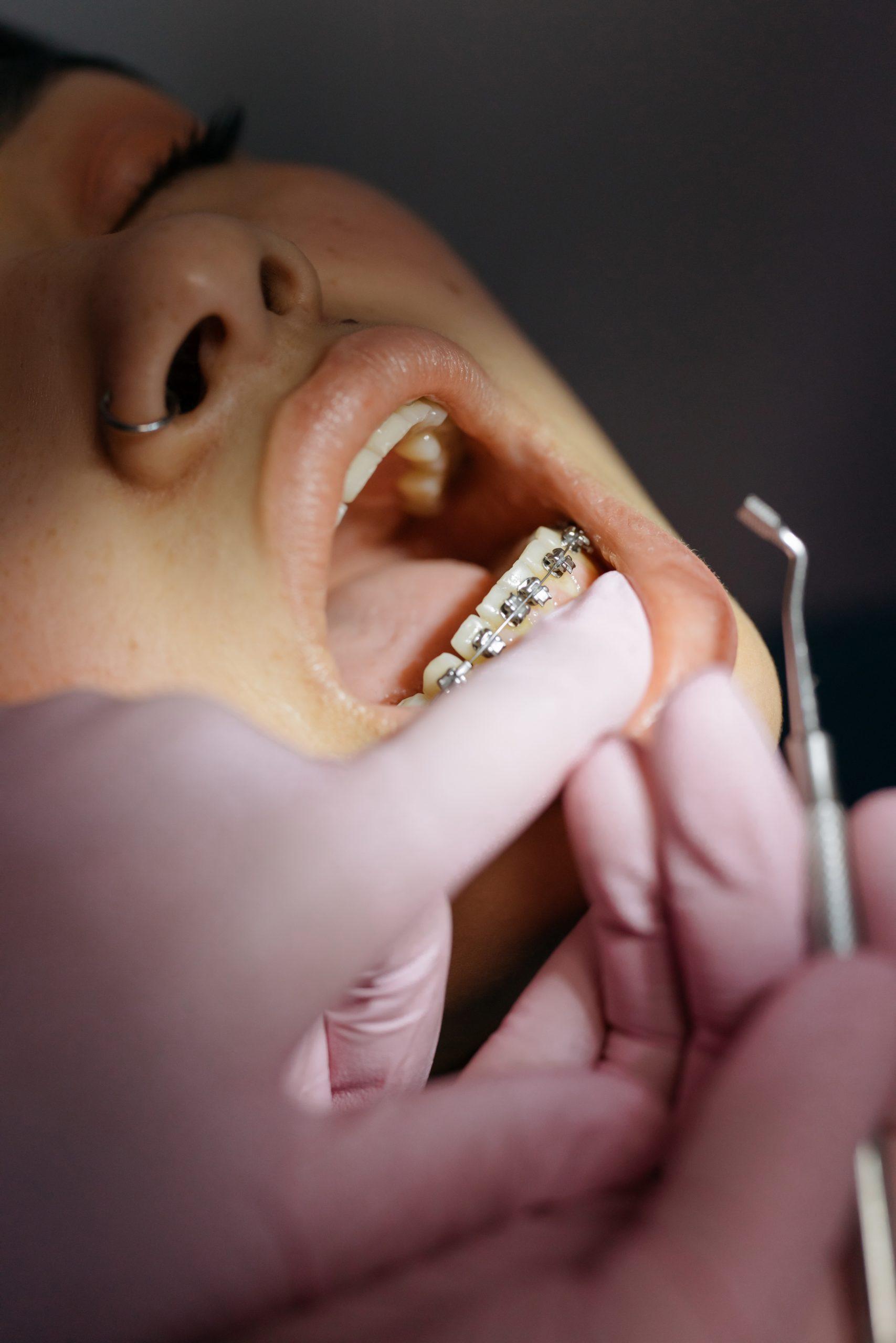 Imagen de la sección Ortodoncia y Odontología estética en Clínica Suma + Dental en Zaragoza