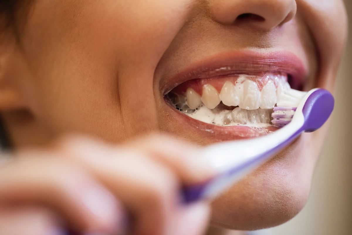 Limpieza dental