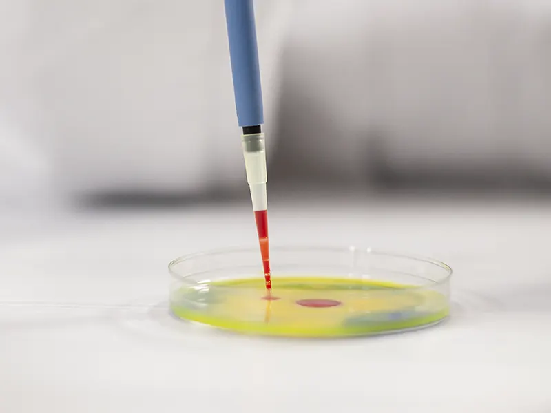 Análisis microbiológico para estudio de enferendades periodontales en petri