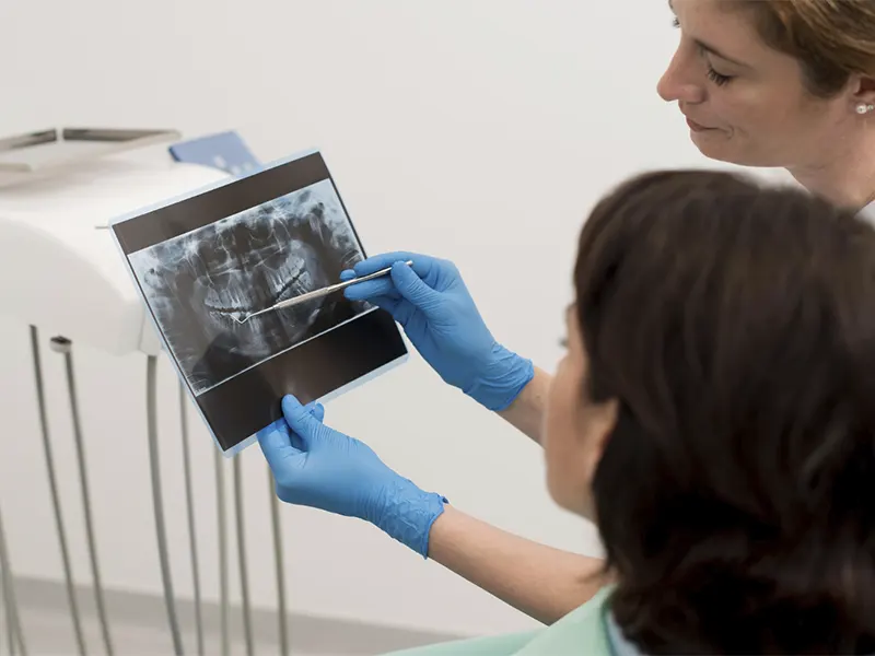 Dentista analizando radiografía para injerto óseo maxilar